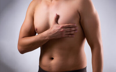 Get a Manlier Chest with a Male Breast Reduction Treatment