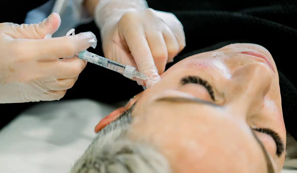 A woman undergoing a facial treatment in a salon, highlighting the microneedling process for enhanced skin texture.