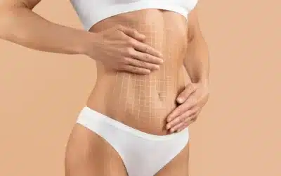 Combining a Breast Lift and Tummy Tuck: What to Know Before You Decide
